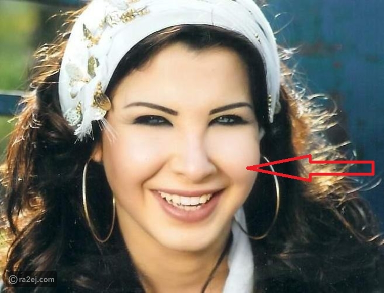 خدود نانسي عجرم المبالغ بها علامة فارقة لها