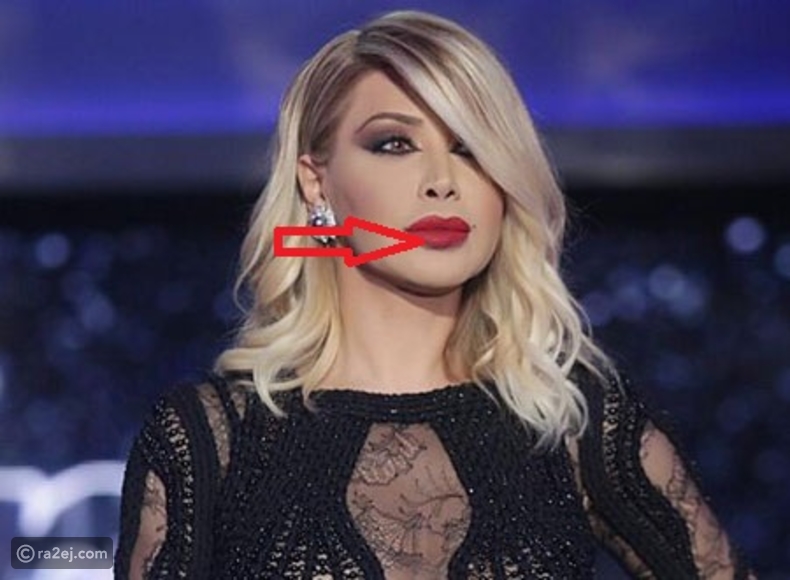 شفاه نوال الزغبي المبالغ بها أصحوا علامة فارقة لها