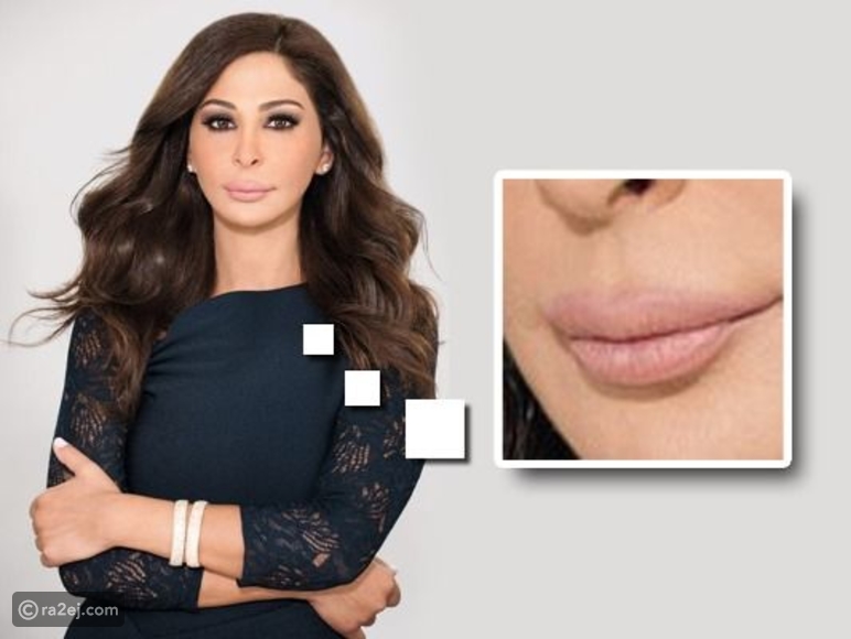 فم إليسا المائل علامة فارقة لها