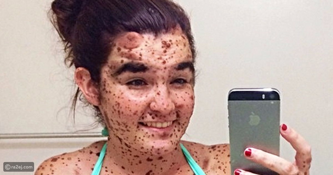 سيرا سوارينجن أصبحت مراهقة عمرها 19 عاماً