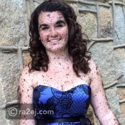 سيرا سوارينجن كانت تلقب الكلب المرقط