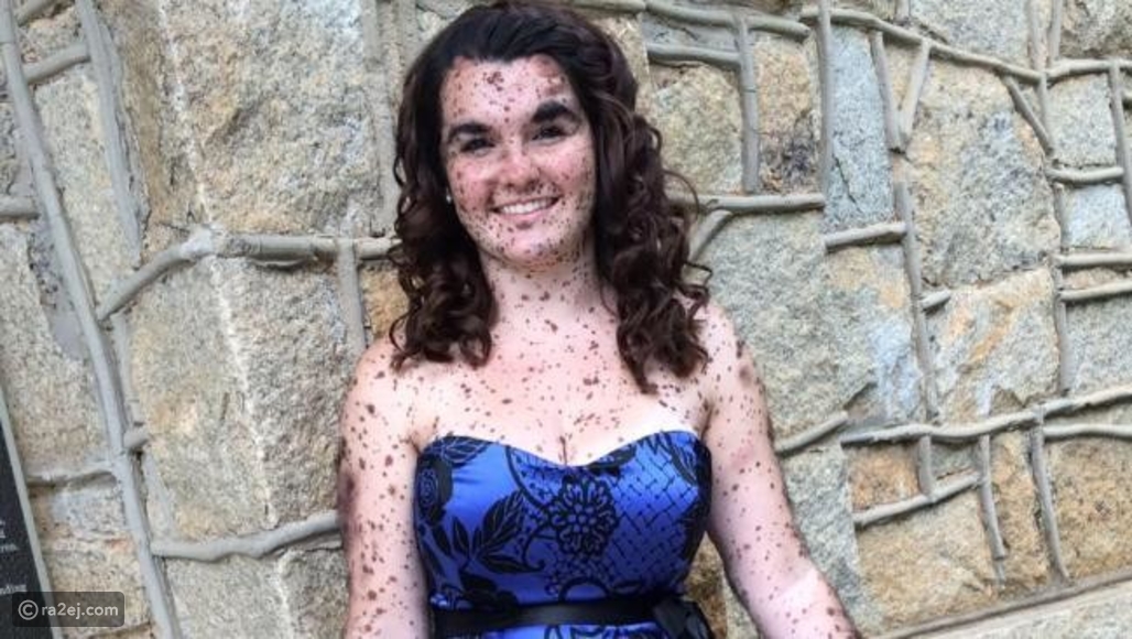 سيرا سوارينجن كانت تلقب الكلب المرقط