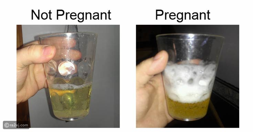 Как отличить мочу. Реакция соды с мочой. Тест на беременность с содой. Сода и моча тест на беременность. Реакция мочи на соду.
