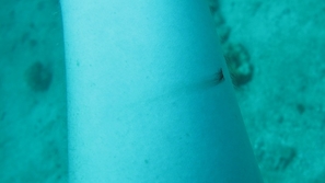 متى يتحول دمّك إلى اللون الأخضر؟ اعرف الإجابة في هذا الفيديو